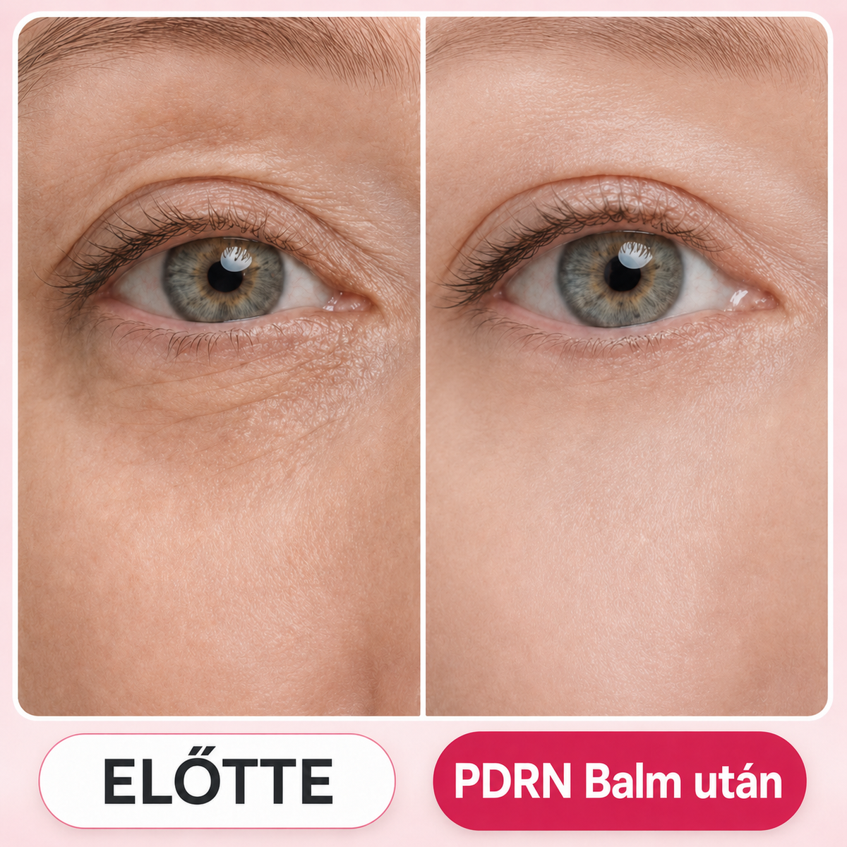 Medicube - PDRN Pink Collagen Volume Multi Balm