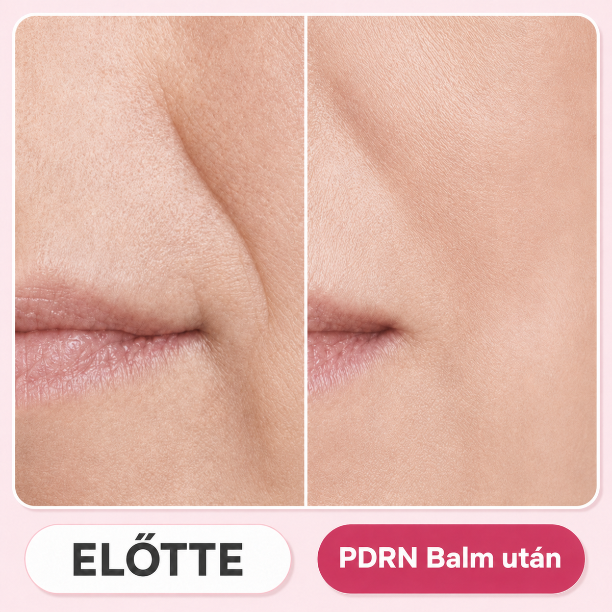 Medicube - PDRN Pink Collagen Volume Multi Balm